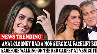 Amal Clooney Had A Non Surgical Facelift Before Walking On The Red Carpet At Venice Film