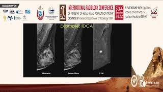 Contrast Enhanced Mammography: Advantages and Future Directions