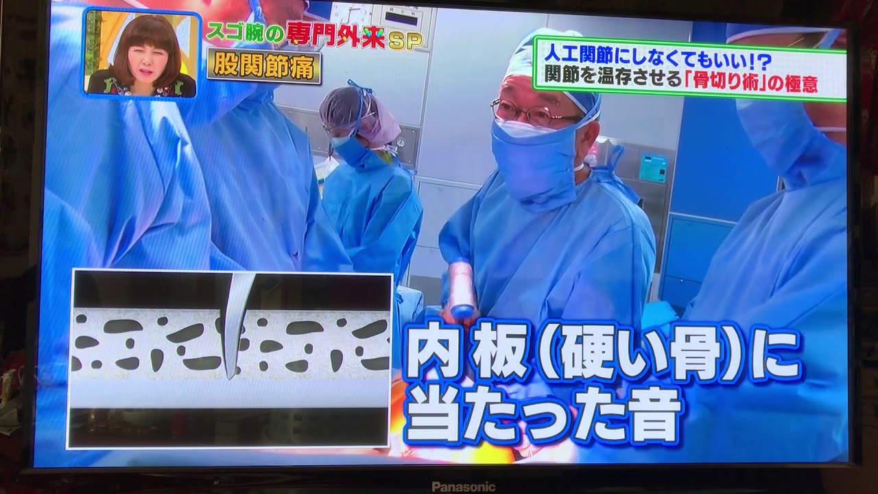 寛骨臼回転骨切り術 11月28日放送 Part4 Youtube