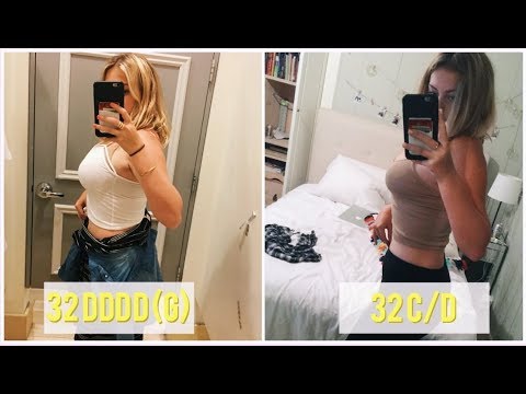 Breast Reduction Surgery At 17 My Experience Advice Youtube