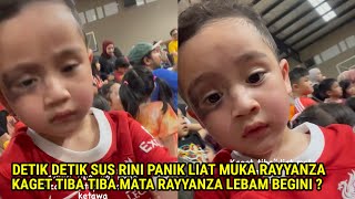 DETIK' SUS RINI PANIK MUKA RAYYANZA BABAK BELUR,MATA RAYYANZA LEBAM BEGINI ?