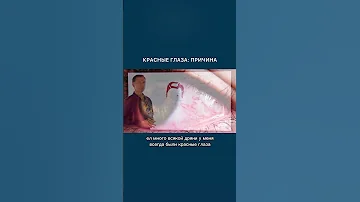 Красные глаза и проблемы с печенью. Красные глаза: причины