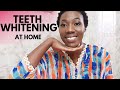 SELF CARE VLOG |Teeth whitening at home, new skin care routine for acne skin, 30 days yoga challenge