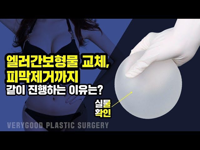 가슴재수술-엘러간텍스쳐보형물 제거+피막전체제거