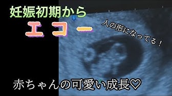 妊娠エコー Youtube