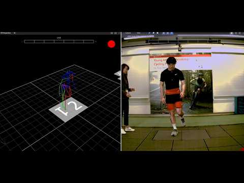 Motion Analysis and Sports Performance Lab: What to Expect - Stanford Medicine Children's Health