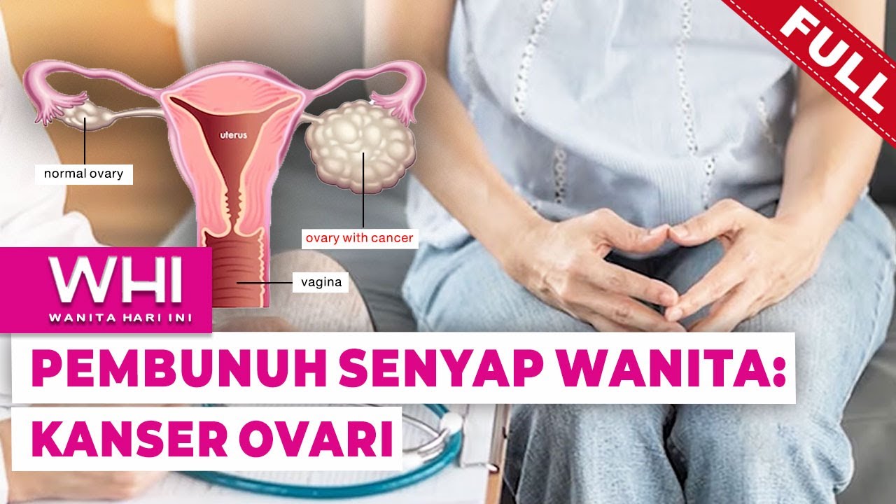[FULL] Wanita Hari Ini (2022) | Pembunuh Senyap Wanita: Kanser Ovari (Thu, Jun 30)