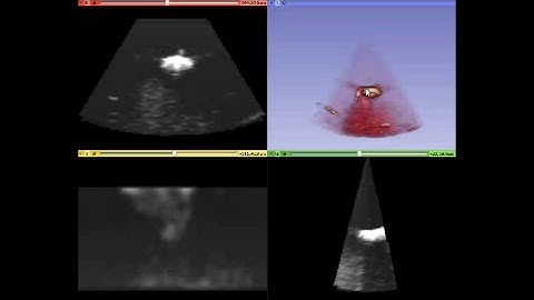 Real-time 4D ultrasound imaging in 3D Slicer using the Plus toolkit