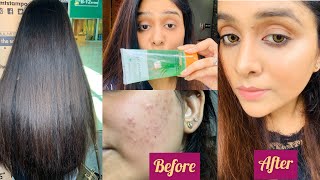 How To Use Patanjali Alovera Gel For YourHair,skin|VocalForLocal|Made In India|Shriya Sharad Saxena screenshot 4