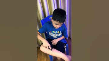 Tại sao cạo gió mãi không ra đen   Cạo gió bạc Bách Chi