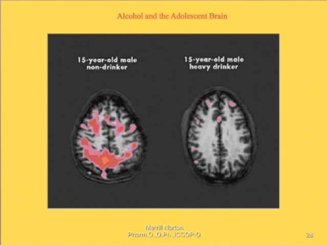 How the Body Responds to Alcohol