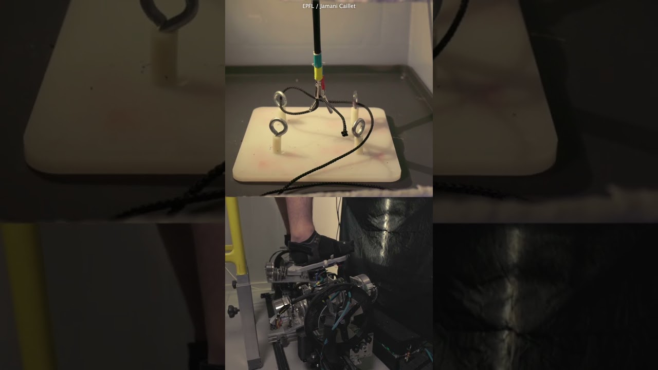 Robot tech will see surgeons operating - with their feet | SWNS