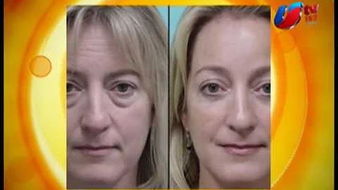 CCM - Dermatologa Sara Salas Bolsas en los Ojos