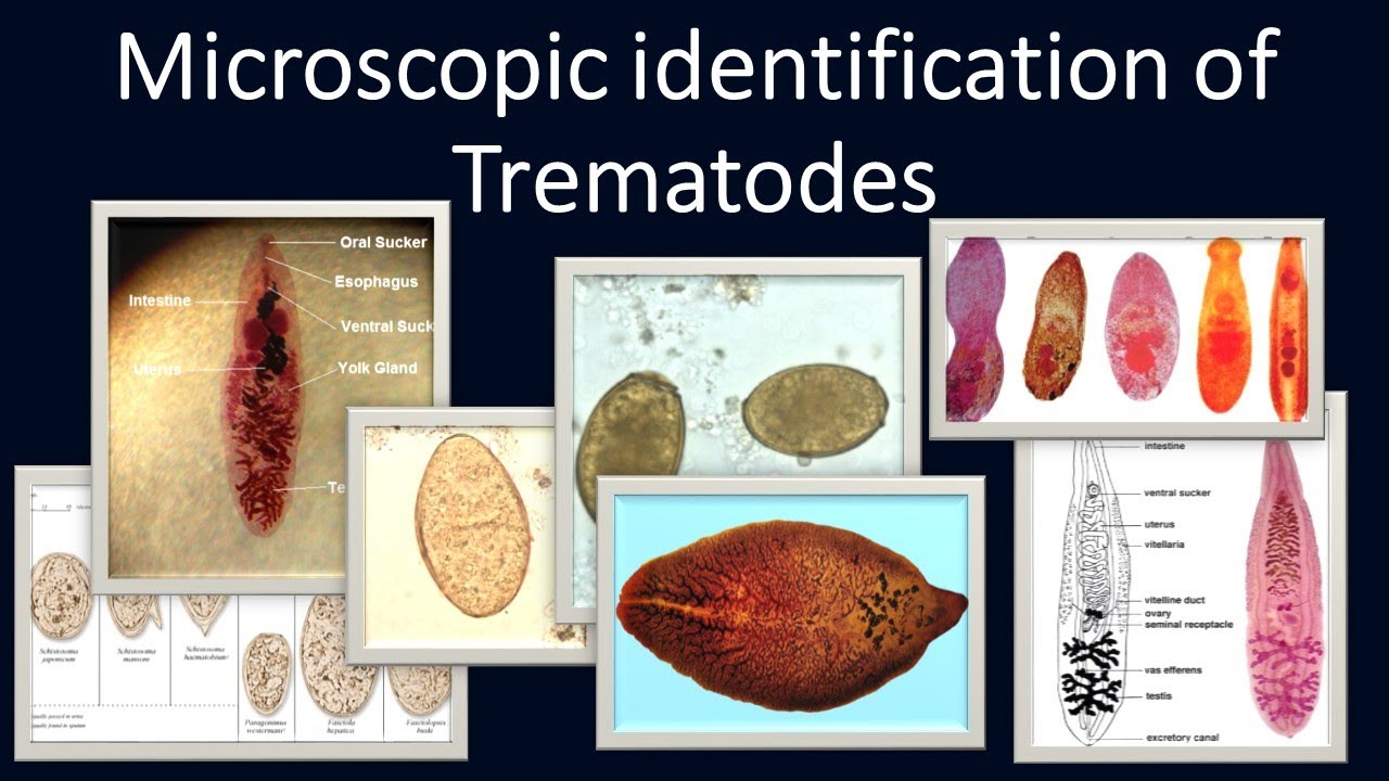 trematode férgek