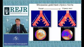 ВОЗМОЖНОСТИ СЦИНТИГРАФИЧЕСКОЙ ДИАГНОСТИКИ  ИШЕМИЧЕСКОЙ БОЛЕЗНИ СЕРДЦА