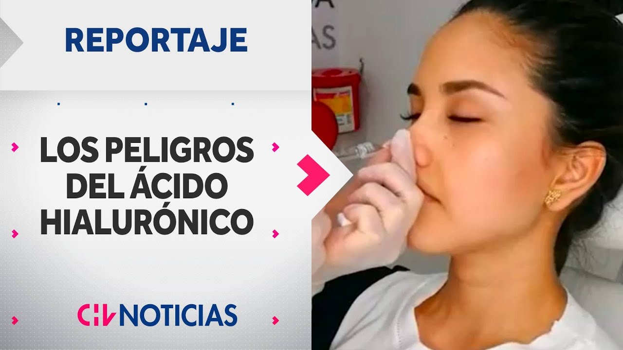 REPORTAJE | Alertan sobre riesgos tras intervenciones estéticas con ácido hialurónico - CHV Noticias