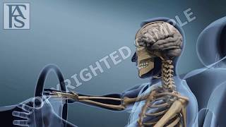 Occupant Kinematic Front Collision