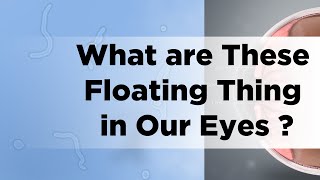 What are These Floating Thing in Our Eyes - Gyan In a Nutshell