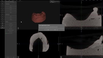 Convert a Model (DICOM) to an STL file in Acteon Imaging Suite