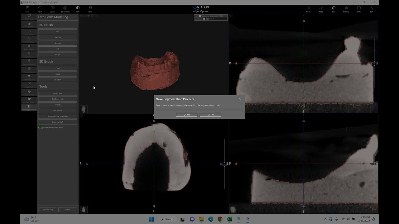 Convert a Model (DICOM) to an STL file in Acteon Imaging Suite