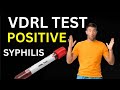 Vdrl Test Kya Hota Hai | Vdrl Tpha Positive Treatment urdu | Vdrl Positive Treatment | Vdrl ka ilaj