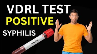 Vdrl Test Kya Hota Hai | Vdrl Tpha Positive Treatment urdu | Vdrl Positive Treatment | Vdrl ka ilaj