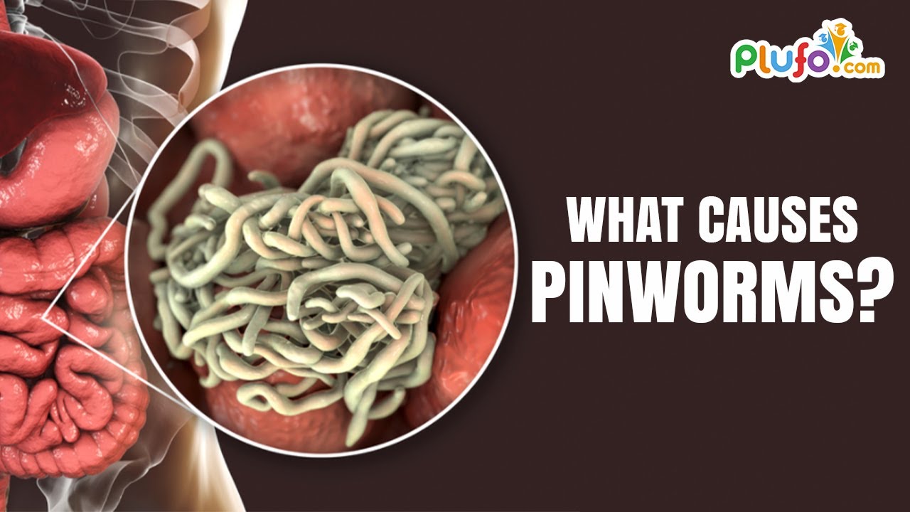 What Causes Pinworms?, Pinworm Symptoms, Best Learning Videos For Kids