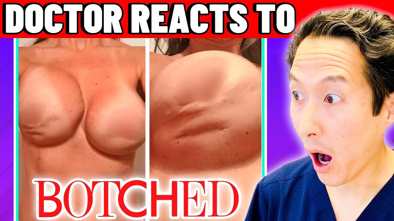 Plastic Surgeon Reacts to BOTCHED: Breasts HARD As ROCKS! 