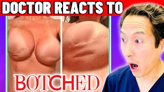 Plastic Surgeon Reacts to BOTCHED: Breasts HARD As ROCKS!