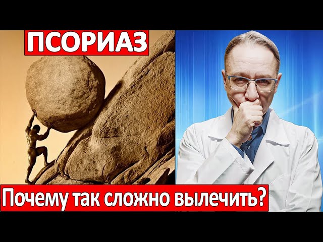 Почему ПСОРИАЗ так сложно ВЫЛЕЧИТЬ