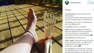 Woman who lost foot to cancer features it on Instagram screenshot 5