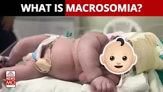 What is Macrosomia?