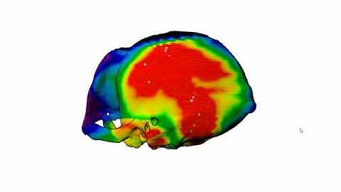 Maximum Intensity Projection Raycasted onto CT in the Monkey Dataset