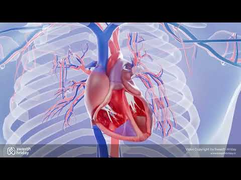 Mitral Valve Prolapse | mitral valve regurgitation | mitral valve prolapse animation | Swasth Hriday