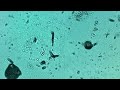 Swimming with plankton 360