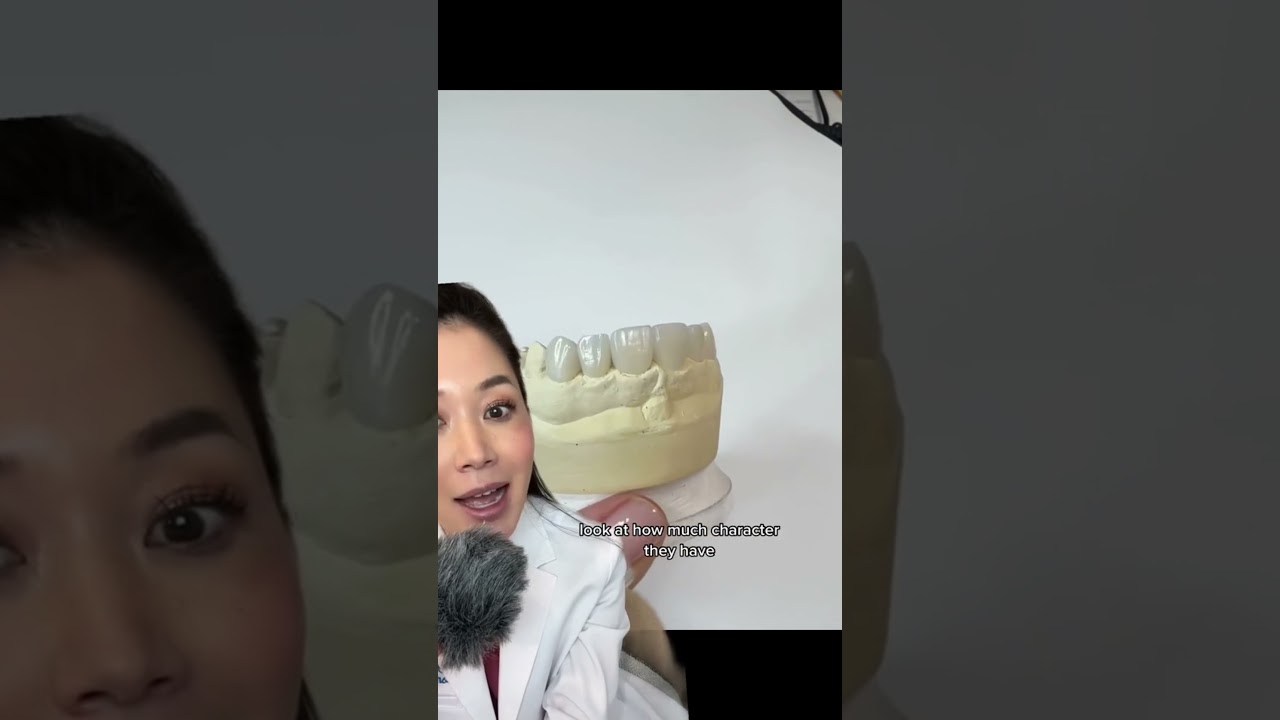 How long does it take the gums to heal after the veneer process? 