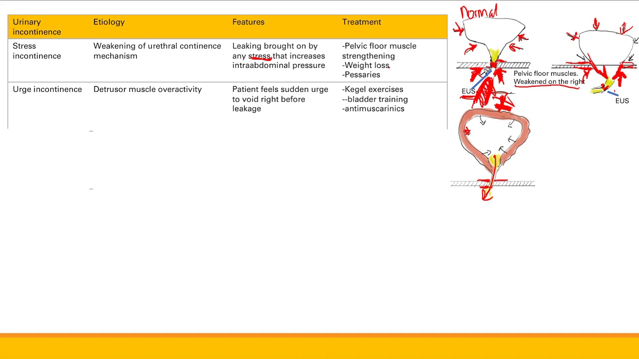 Urinary incontinence | Renal system | Step 1 Simplified - YouTube