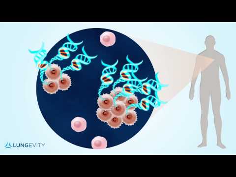 Video: EGFR-, KRAS-, BRAF-, ALK- Og CMET-genetiske Endringer Hos 1440 Sardinske Pasienter Med Lungeadenokarsinom