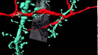 3D-reconstruction of nerve cells