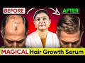 Best Hair Growth Serum Minoxidil Hair Regrowth Results Rosemary Oil For Hair Growth Hairstyle 