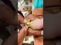 IV cannula fixer #childhood #nicee #baby #youtube #youtubeshorts #youtuber #youtubeshort