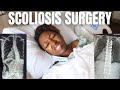 Scoliosis Surgery Vlog | Spinal Fusion 2021