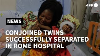 Conjoined twins separated successfully in Italy | AFP