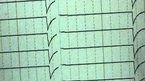 EEG CALIBRATION SIGNALS.mpg