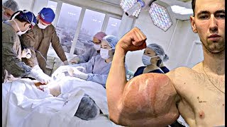 False Muscular Operation