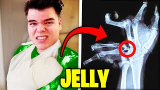 6 ACCIDENTAL Injuries In YouTube Videos! (Jelly, DanTDM, Preston, MrBeast)