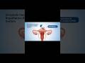 1 chhoti pill pregnancy kaise rok deti hai? 3D animation #pregnancy #shorts #viral