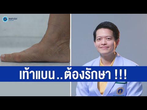 เท้าแบน ภาวะร้าย...ไร้อุ้งเท้า | พบหมอมหิดล [by Mahidol Channel]