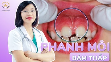 Phanh Môi Bám Thấp: Những Điều Cần Biết Và Cách Xử Lý An Toàn | Bác sĩ Trung Long Biên