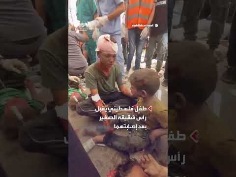 طفل فلسطيني يقبل رأس شقيقه المصاب في غزة بعد قصف إسرائيلي